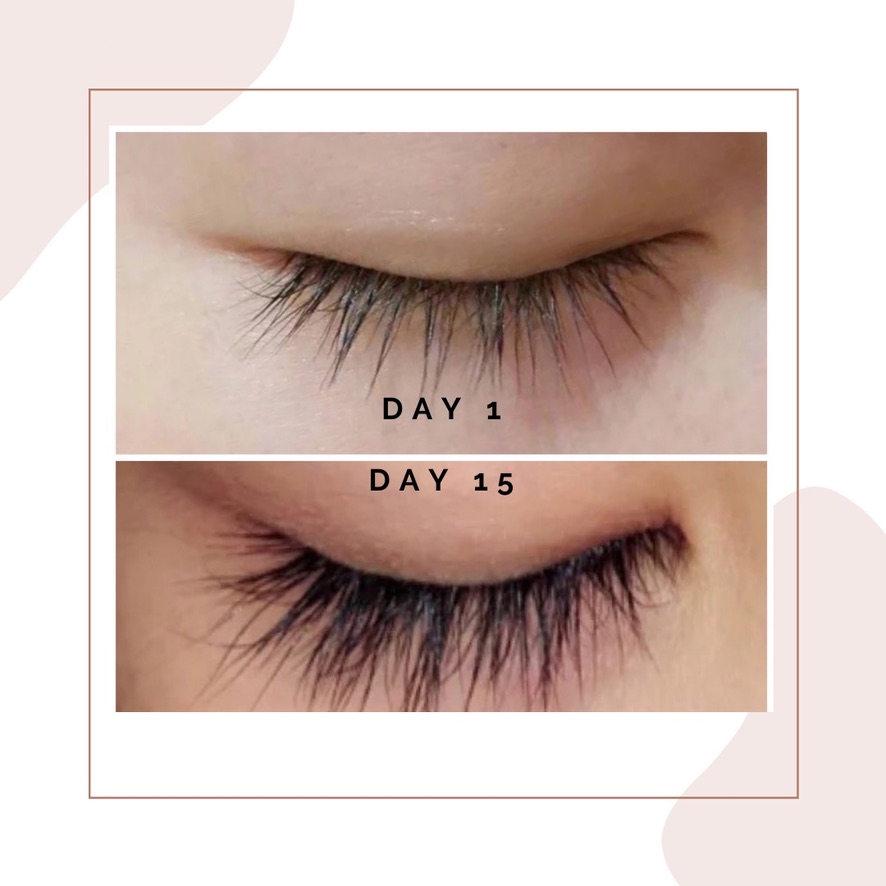 Client before and after, healthier-looking lash line