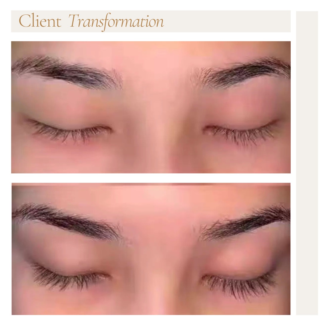 Client before and after, visible density